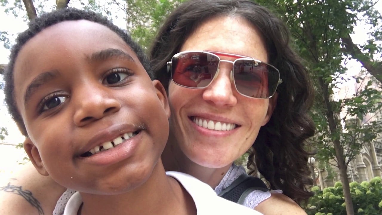 All on Four Dental Implants Rachel's Story Video Thumbnail